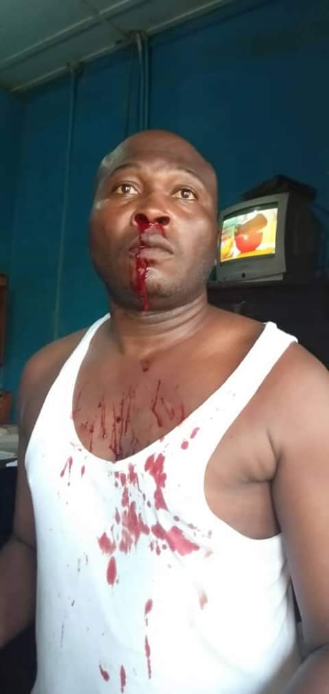 Police officer beaten up at work by 5 built men at Wassa Akropong&nbsp;.